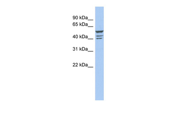 ZNF140 Rabbit Polyclonal Antibody