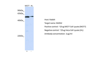 BARX2 Rabbit Polyclonal Antibody