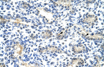 BLZF1 Rabbit Polyclonal Antibody