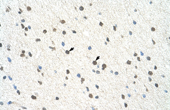 BLZF1 Rabbit Polyclonal Antibody