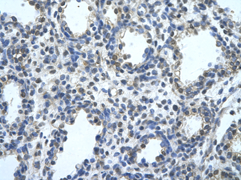 BLZF1 Rabbit Polyclonal Antibody