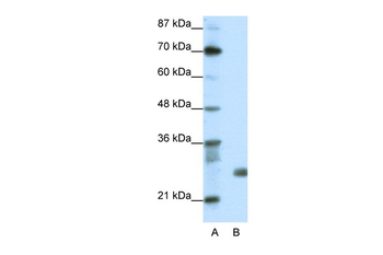 SAP30 Rabbit Polyclonal Antibody