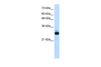 SAP30 Rabbit Polyclonal Antibody