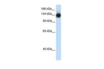 TIMELESS Rabbit Polyclonal Antibody