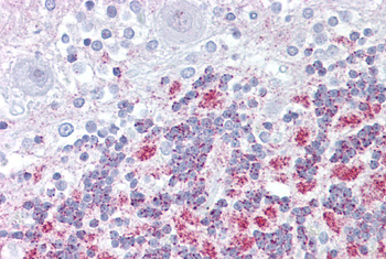 E2F2 Rabbit Polyclonal Antibody