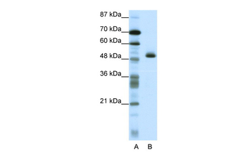 ZNF213 Rabbit Polyclonal Antibody