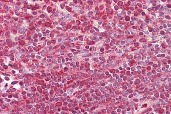 EGR3 Rabbit Polyclonal Antibody