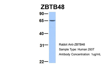 ETV5 Rabbit Polyclonal Antibody