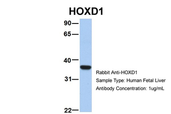 ETV5 Rabbit Polyclonal Antibody
