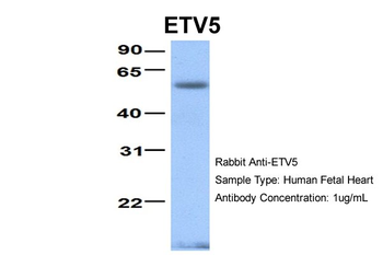 ETV5 Rabbit Polyclonal Antibody
