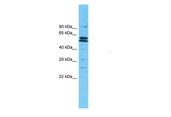 MLLT3 Rabbit Polyclonal Antibody