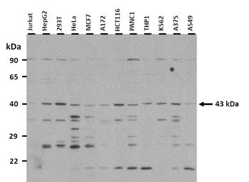 POU4F2 Rabbit Polyclonal Antibody