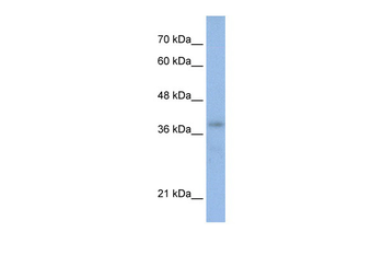 POU4F2 Rabbit Polyclonal Antibody