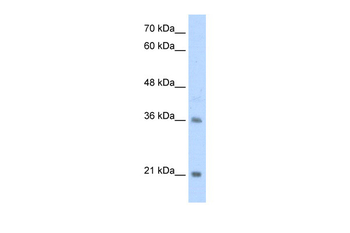 TCF15 Rabbit Polyclonal Antibody