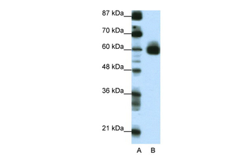 CIR Rabbit Polyclonal Antibody