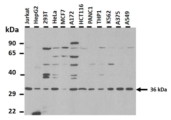ZFP36L1 Rabbit Polyclonal Antibody
