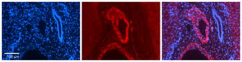 ZFP36L1 Rabbit Polyclonal Antibody