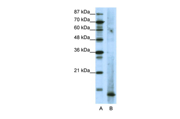 MDS1 Rabbit Polyclonal Antibody