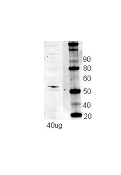 NRF1 Rabbit Polyclonal Antibody