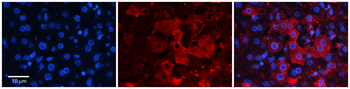 ZNF142 Rabbit Polyclonal Antibody