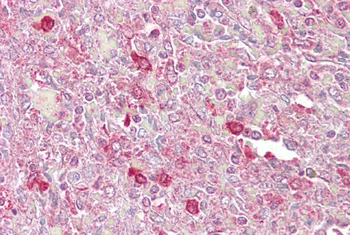 ATF1 Rabbit Polyclonal Antibody