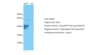 DLX3 Rabbit Polyclonal Antibody