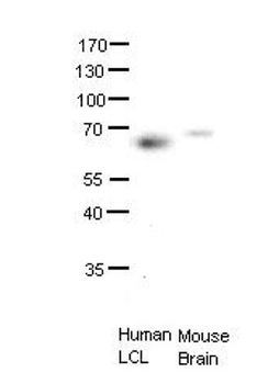 ETS2 Rabbit Polyclonal Antibody