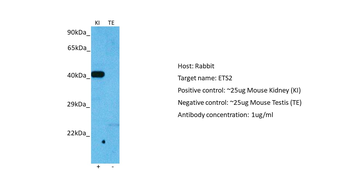 ETS2 Rabbit Polyclonal Antibody