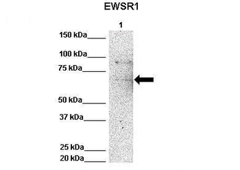 EWSR1 Rabbit Polyclonal Antibody