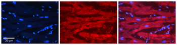 EWSR1 Rabbit Polyclonal Antibody