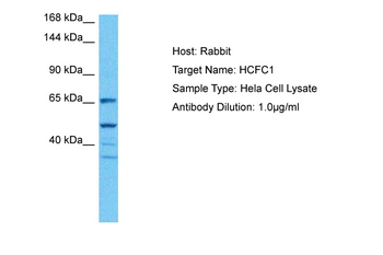 HCFC1 Rabbit Polyclonal Antibody