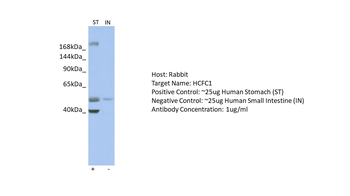 HCFC1 Rabbit Polyclonal Antibody