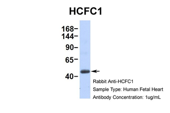 HCFC1 Rabbit Polyclonal Antibody