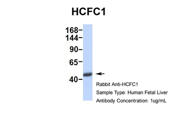 HCFC1 Rabbit Polyclonal Antibody