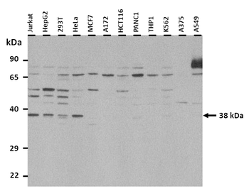 MAF Rabbit Polyclonal Antibody