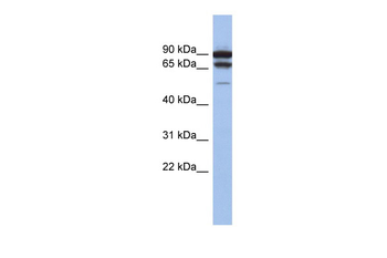 TP73 Rabbit Polyclonal Antibody