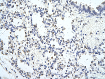 MED6 Rabbit Polyclonal Antibody