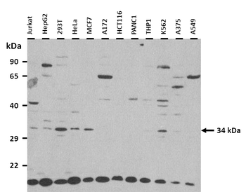 TLX1 Rabbit Polyclonal Antibody