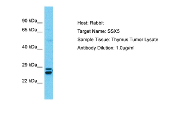 SSX5 Rabbit Polyclonal Antibody