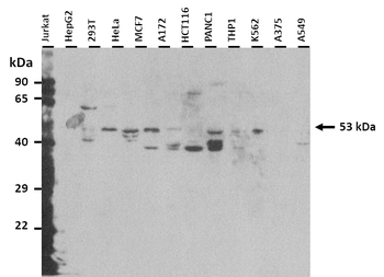 KLF10 Rabbit Polyclonal Antibody