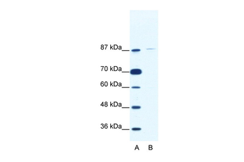 TAF1C Rabbit Polyclonal Antibody