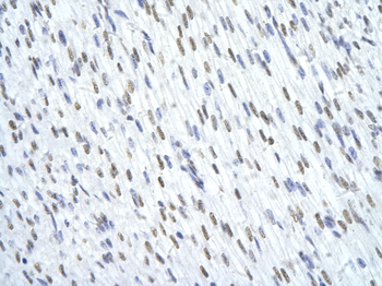 TRIM28 Rabbit Polyclonal Antibody