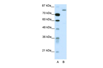 TRIM28 Rabbit Polyclonal Antibody