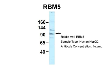 RBM5 Rabbit Polyclonal Antibody