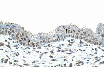 SMAD1 Rabbit Polyclonal Antibody