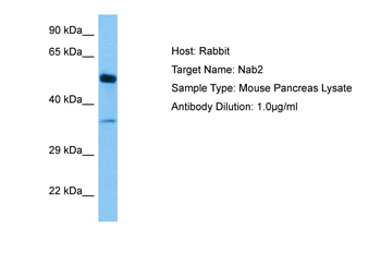 NAB2 Rabbit Polyclonal Antibody