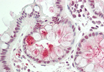 TSC22D1 Rabbit Polyclonal Antibody