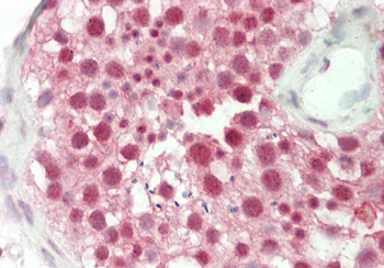 TSC22D1 Rabbit Polyclonal Antibody