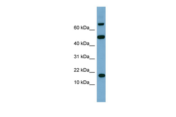 TSC22D1 Rabbit Polyclonal Antibody