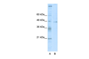 TSG101 Rabbit Polyclonal Antibody